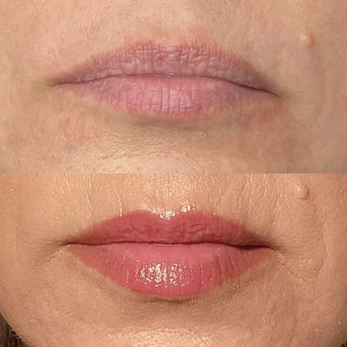 Before and After 2 - Permanent Lipstick from Dermaluxe Spa - Come To Dermaluxe Spa Today to Get Your Permanent Makeup Done