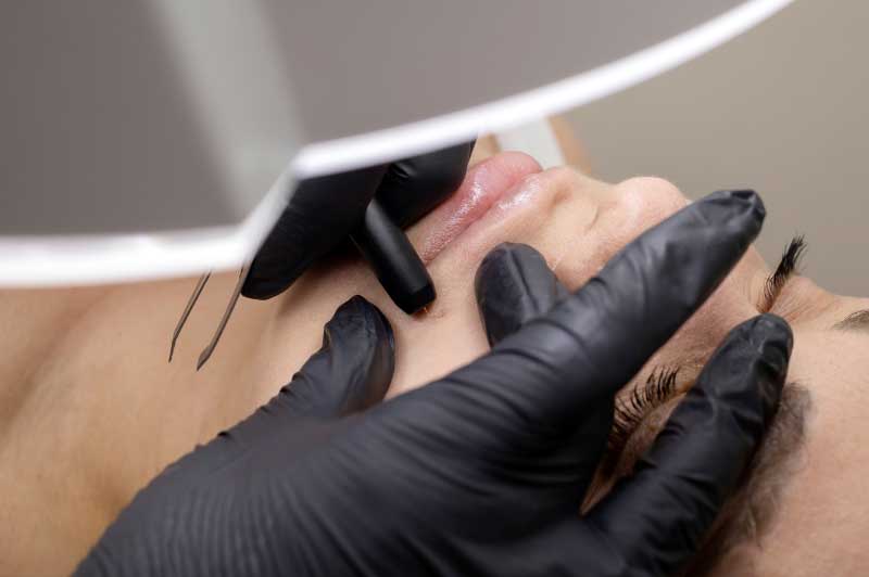 Dermaluxe Spa Now Offers Electrolysis in Houston Texas - Come try out our new Silhouet Tone Evo XHD - Call now or book online with Dermaluxe Spa