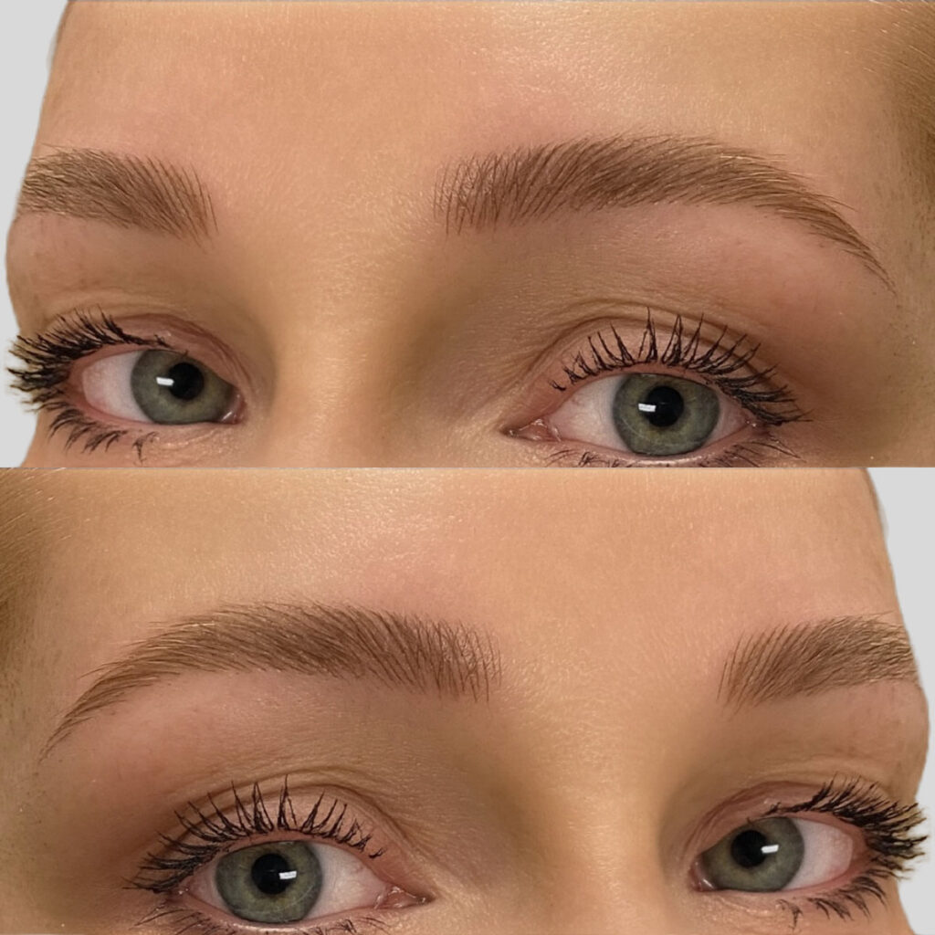 Gallery Before and After - Permanent Eyebrows Microblading from Dermaluxe Spa - Come To Dermaluxe Spa